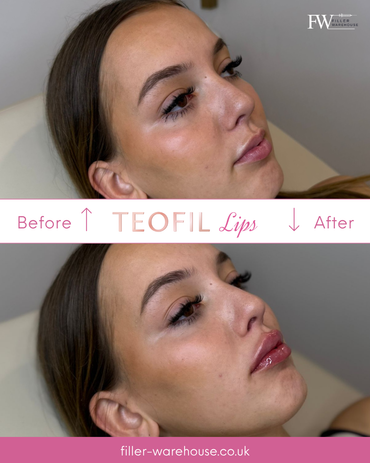 TEOFIL Lips