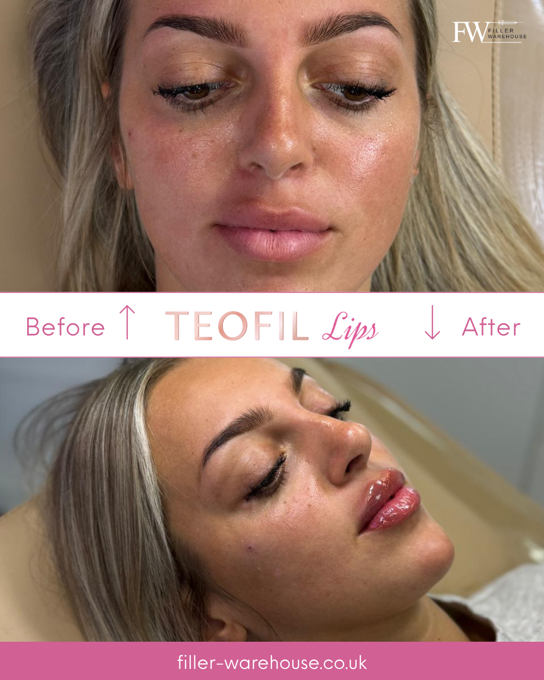 TEOFIL Lips