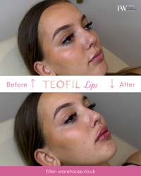 TEOFIL Lips